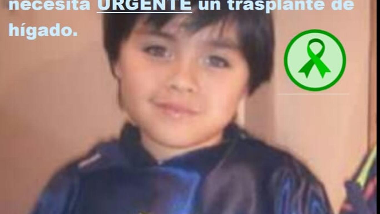 Grave menor de 6 años que espera trasplante de hígado