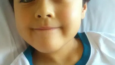 Finalizó trasplante de Ignacio