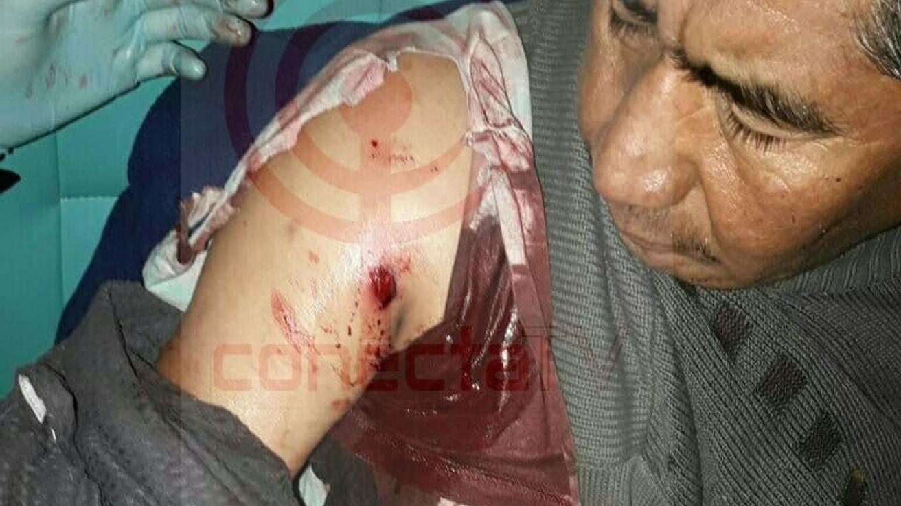 Comuneros mapuches fueron lesionados a tiros
