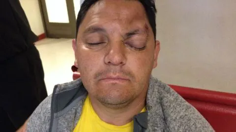 Hombre quedó en riesgo vital tras recibir chorro de carro lanzaguas de carabineros en Concepción