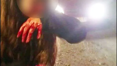 El increíble final que tuvo la brutal agresión de una joven por parte de su pololo en Talcahuano