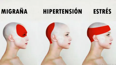 Como aliviar el dolor de cabeza en 5 minutos