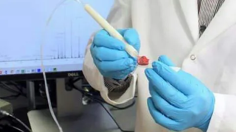 En sólo 10 segundos este invento permite detectar el cáncer