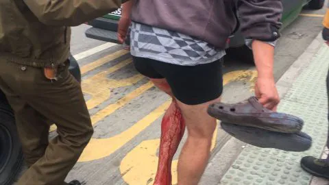 Delincuente pasa corriendo ensangrentado frente a Carabineros