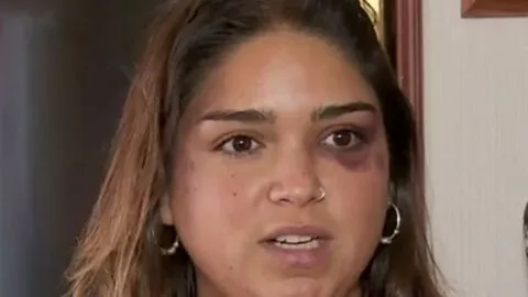 Hija de destacado humorista de Chiguayante sufrió ataque sexual de un taxista