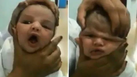Despiden a enfermeras de hospital por maltratar a guagua recién nacida
