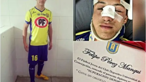La UdeC premió a juvenil que trancó con la cara y quedó inconsciente