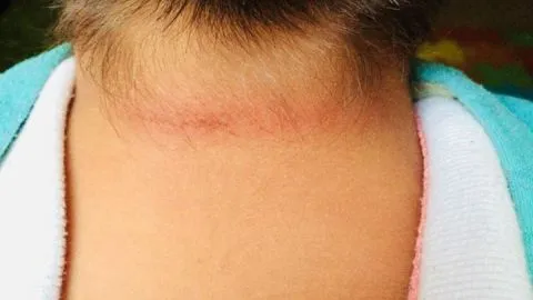 Madre denuncia grave agresión a su hijo de 6 años en escuela de Los Ángeles