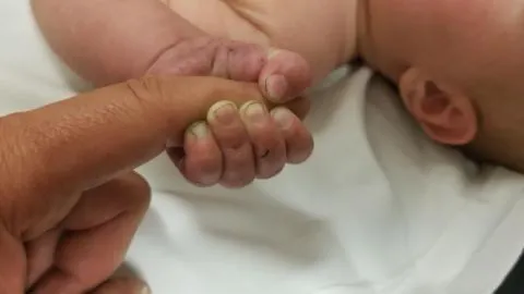 Bebé de 5 meses sobrevive tras ser enterrado vivo en un bosque