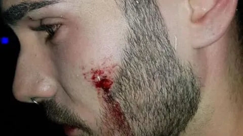 Joven gay denuncia agresión en una discoteca luego de besar a su novio