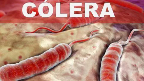 Ministerio de salud confirmó siete casos de cólera en el país