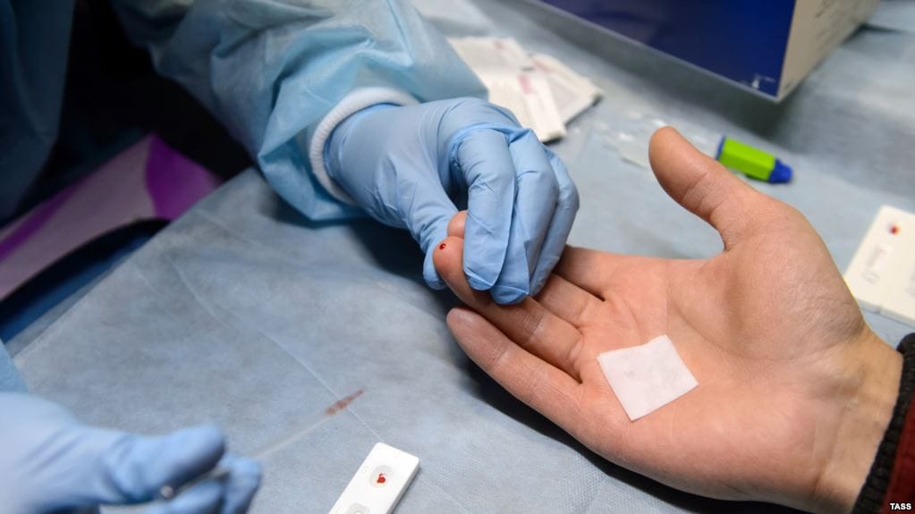 Test rápido de VIH: Revisa donde hacerte el examen