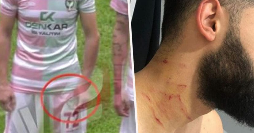 VIDEO| Jugador turco agredió a sus rivales con una hoja de afeitar