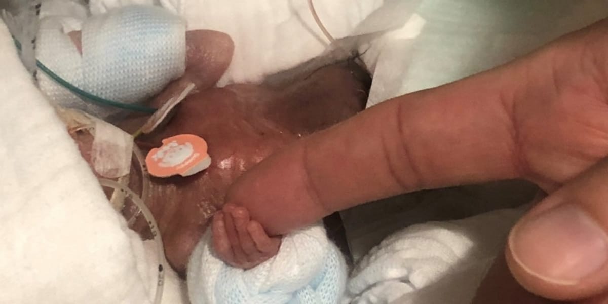 Dan de alta a la guagua más pequeña del mundo: Sólo pesó 268 gramos