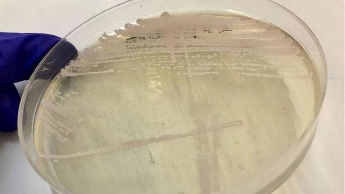 Primer caso de Candida auris en Chile: El peligroso hongo que amenaza la salud mundial