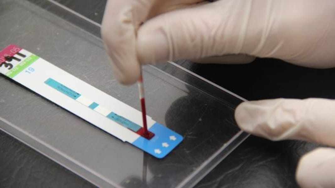 Más de 6 mil 600 test rápidos de VIH se han tomado hasta la fecha en el Biobío