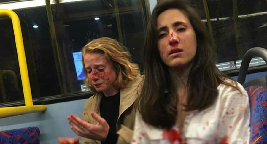 Brutal ataque lesbofóbico recibe una pareja Londres: “Pedían que nos besáramos”