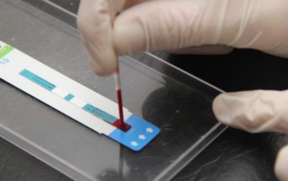 69 test rápidos han sido reactivos a VIH en el Biobío