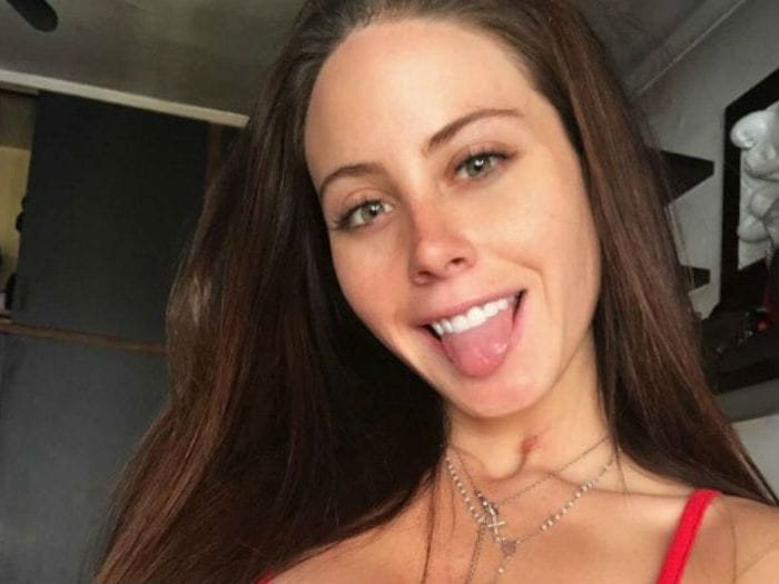 El drama que vive Ignacia Michelson tras descubrir que le pusieron metacril en los glúteos