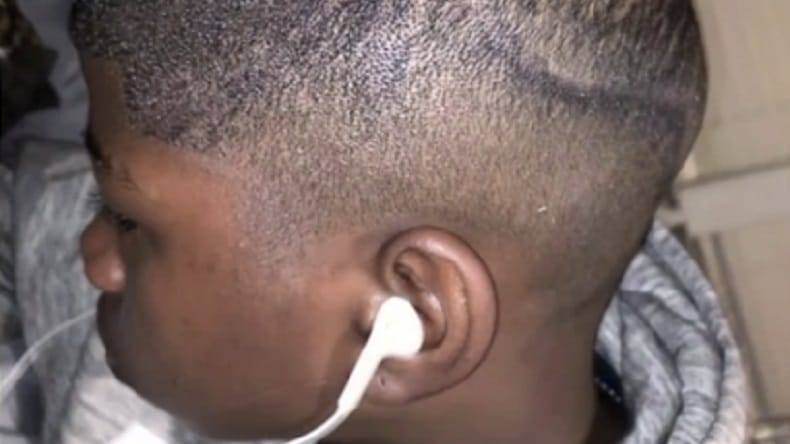 Niño es rayado con plumón por profesores por su corte de pelo