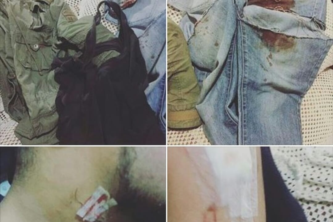 Penquista acusa haber sido brutalmente apuñalado por cinco asaltantes extranjeros en calle Castellón