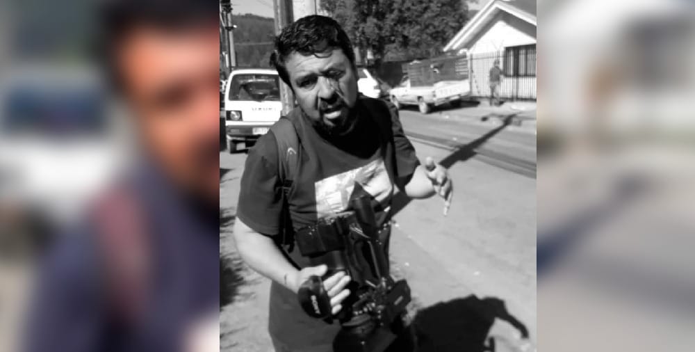 Oficial de Carabineros de Chiguayante reconoció haber disparado balín que hirió ojo de camarógrafo