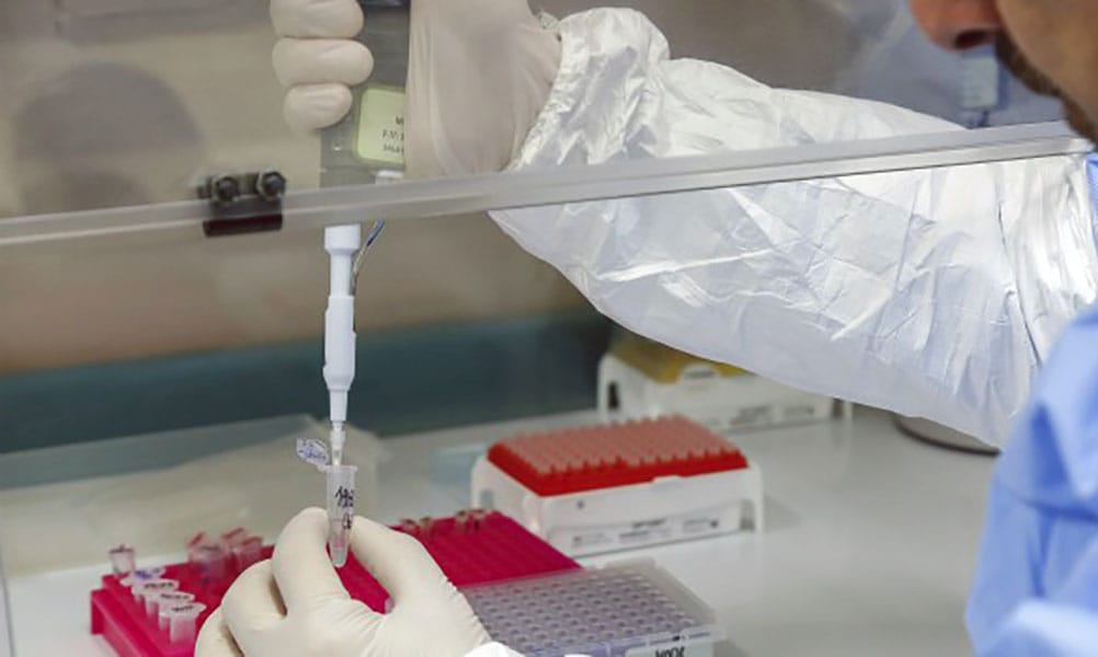 Confirman séptimo caso de coronavirus en Chile