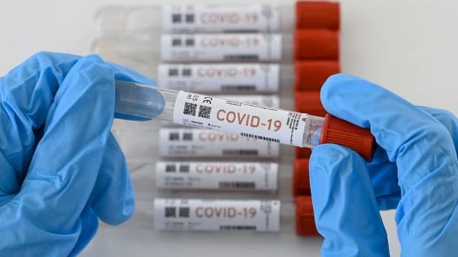 Fuerte incremento de nuevos casos Covid-19 en la Región del Biobío
