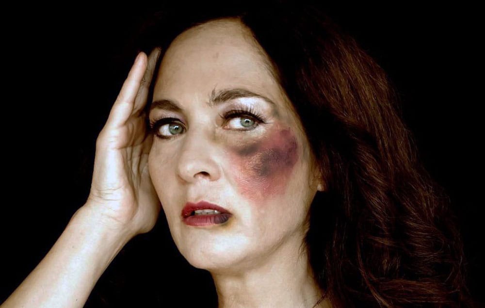 Actriz Alejandra Herrera compartió cruda fotografía con sentido mensaje