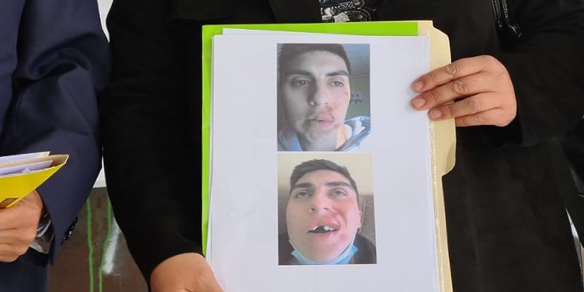 Interponen recurso de amparo contra Carabineros de Chiguayante por brutal golpiza a estudiante
