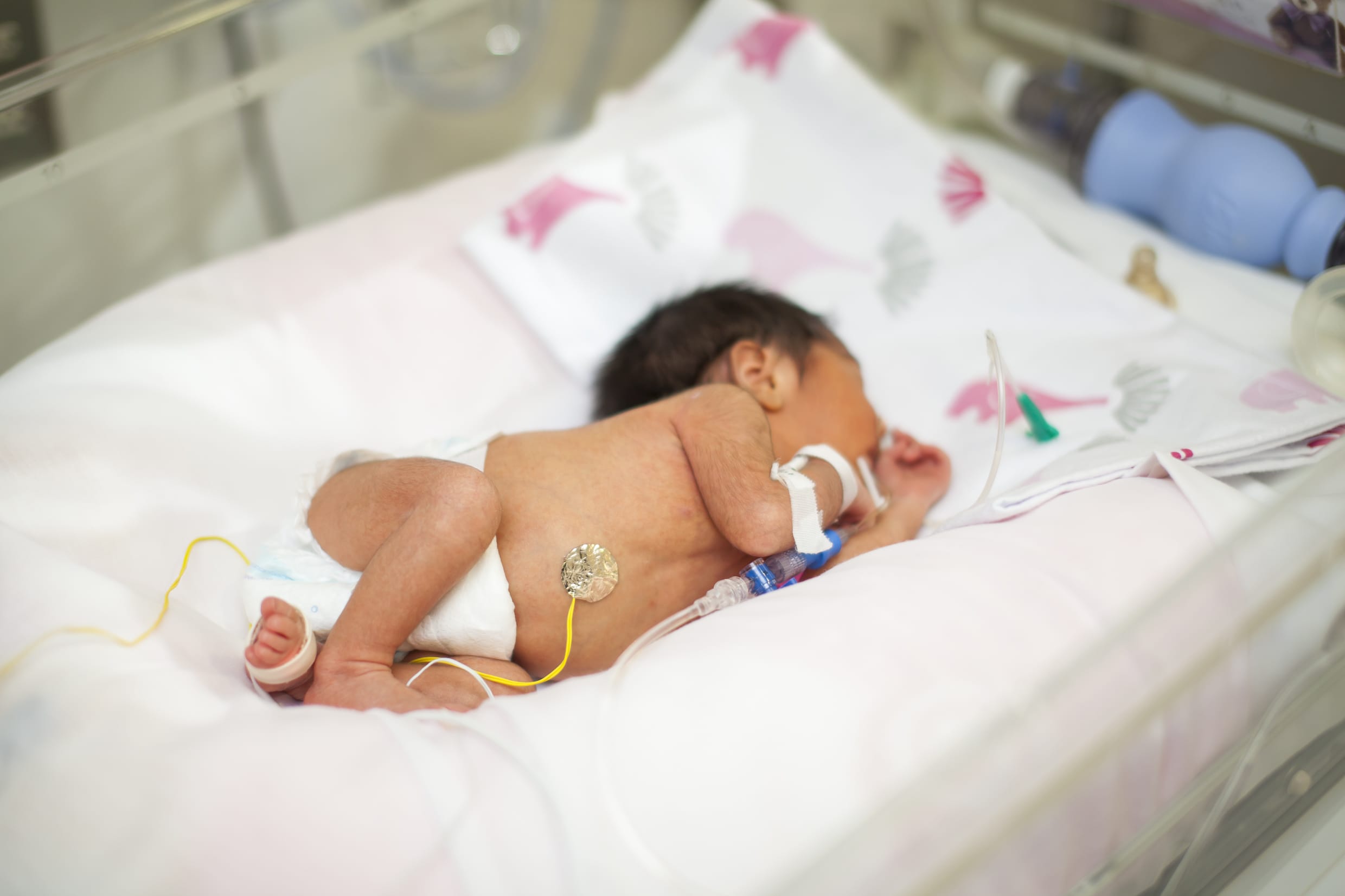 Neonatología de Sanatorio Alemán implementa musicoterapia en bebés prematuros