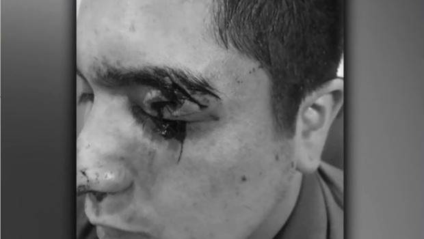 Guardia del Metro sufrió brutal agresión: Sujeto lo apuñaló en el ojo