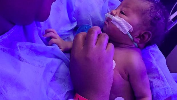 Bebé de un año supera el Covid-19 y un trasplante de hígado en menos de dos meses