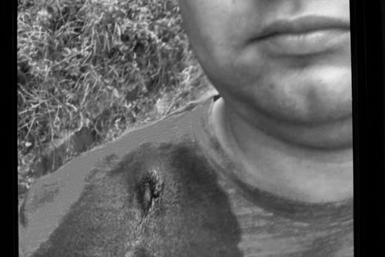 Dramático relato de camionero baleado en Contulmo: “Tengo temor de seguir en los camiones”