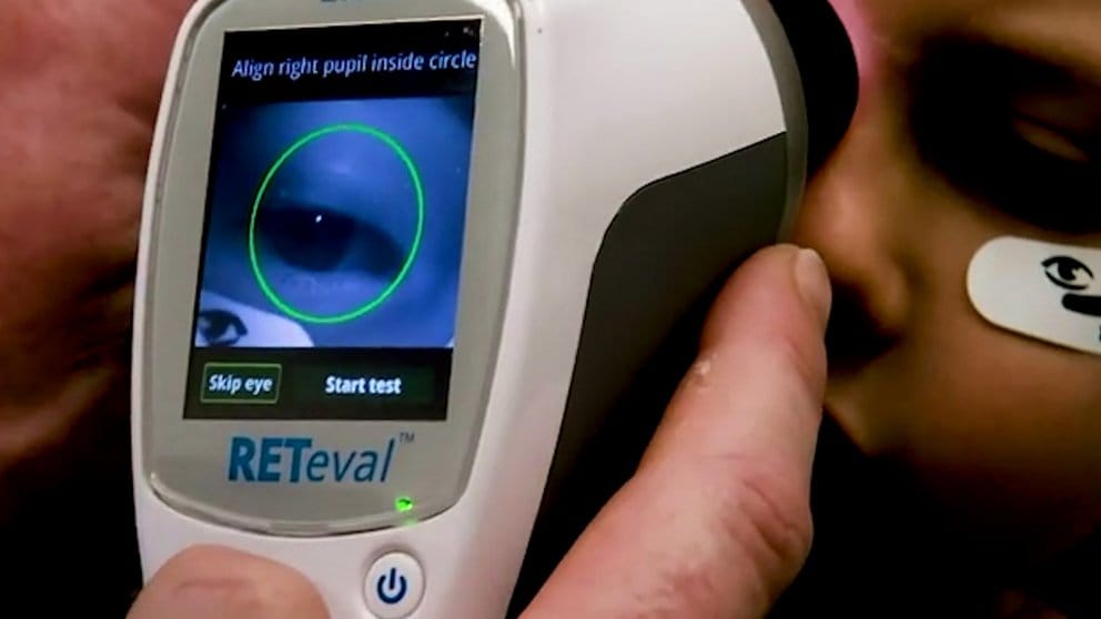 Test de retina con cámara de alta resolución permitiría detectar trastornos del espectro autista