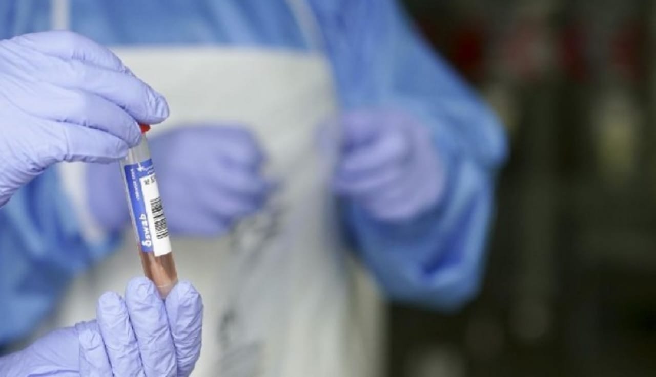 Confirman primer caso de variante brasileña del Covid-19 en Biobío