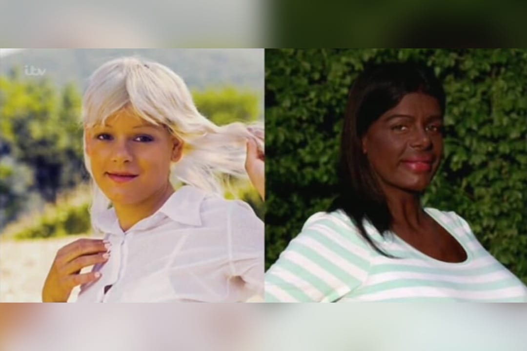 Martina Big: La mujer rubia que cambió el color de su piel para convertirse en africana
