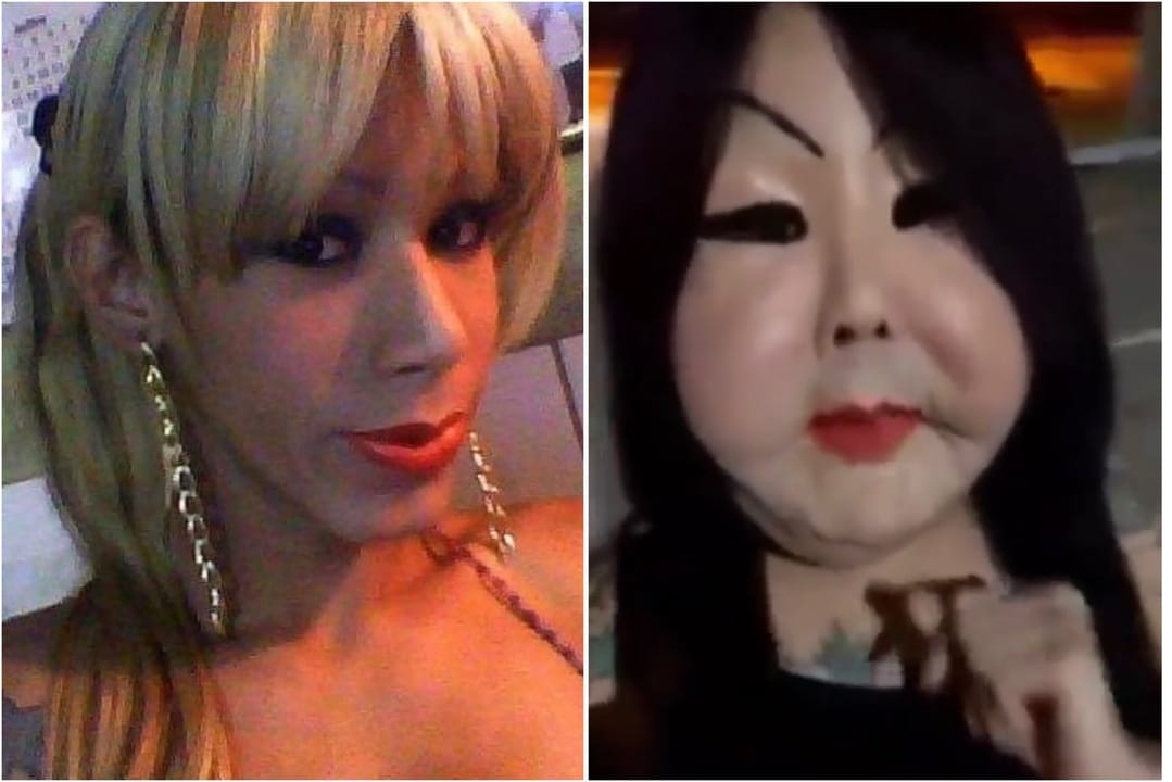 Mujer trans se inyecta silicona industrial en el rostro y sus mejillas se deforman