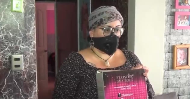 Mujer perdió todo su pelo luego de aplicarse un producto alisante