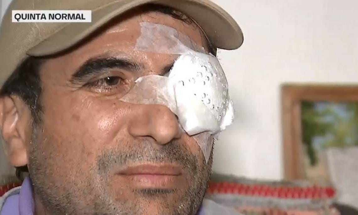 Candidato a concejal recibió disparo de balín en su ojo en Quinta Normal