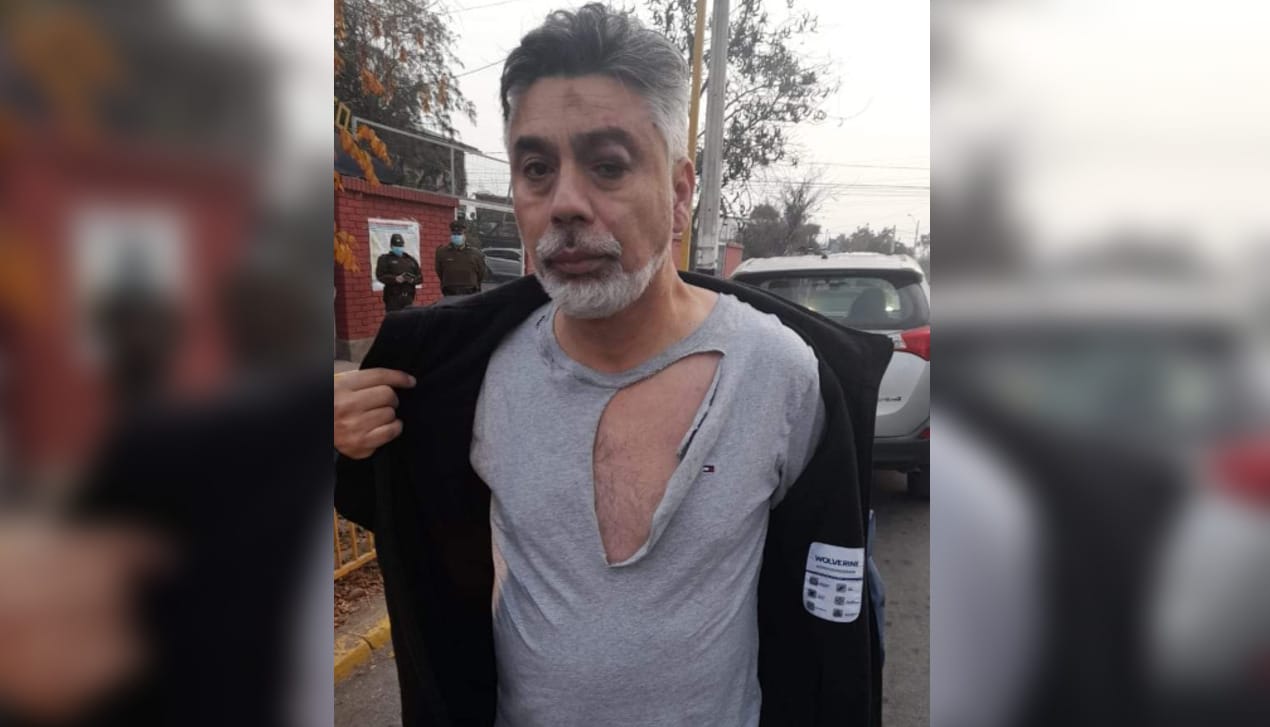 Candidato denunció recibir golpiza de parte de simpatizantes del actual alcalde de Lo Espejo