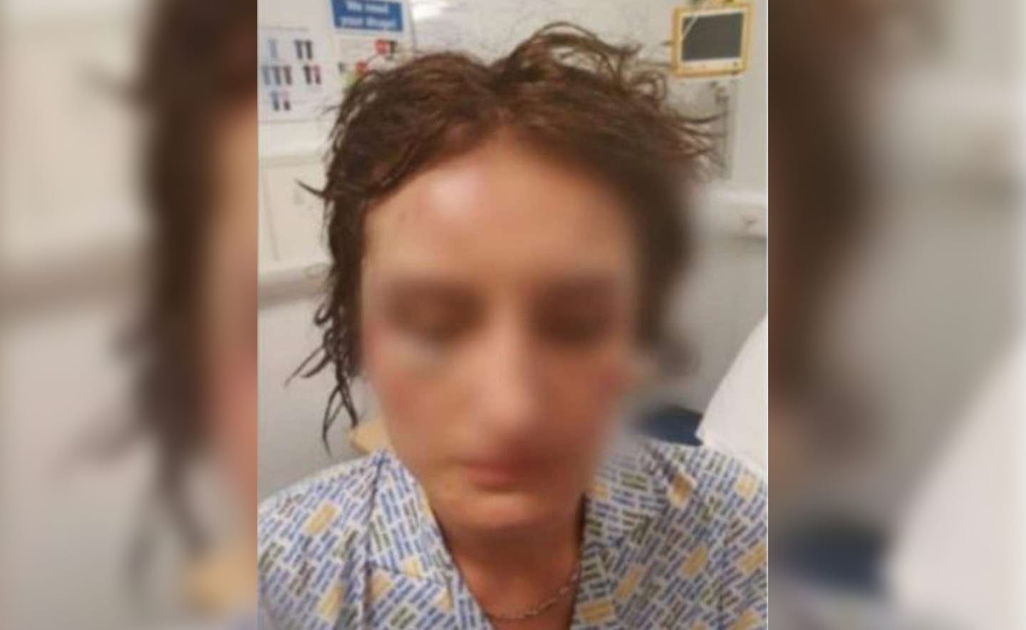 Mujer descubrió que encapuchado que la atacó era su marido