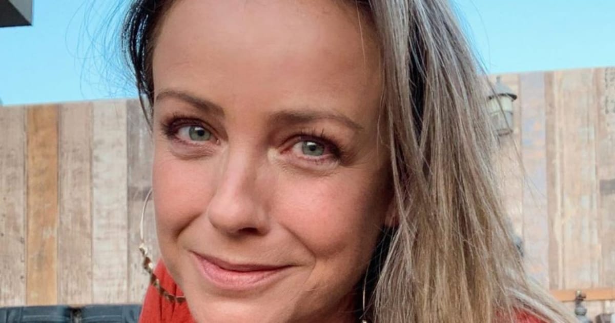 Claudia Conserva mostró las secuelas del doloroso accidente doméstico que sufrió