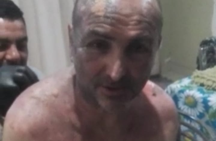 “Si hubiese sido yo el que hacía eso, me voy preso”: Mujer atacó a su expareja con agua hirviendo