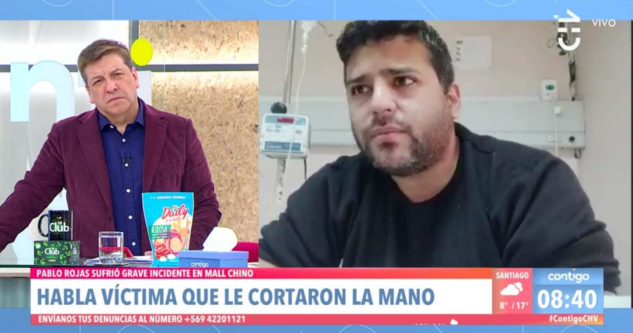 “Me embarró la vida”: El crudo testimonio de hombre que perdió la mano tras discusión en Mall Chino