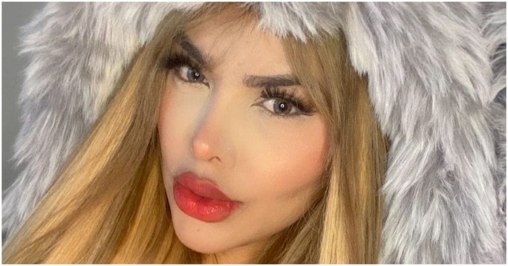 Influencer le regaló una rinoplastia a su hija de 12 años