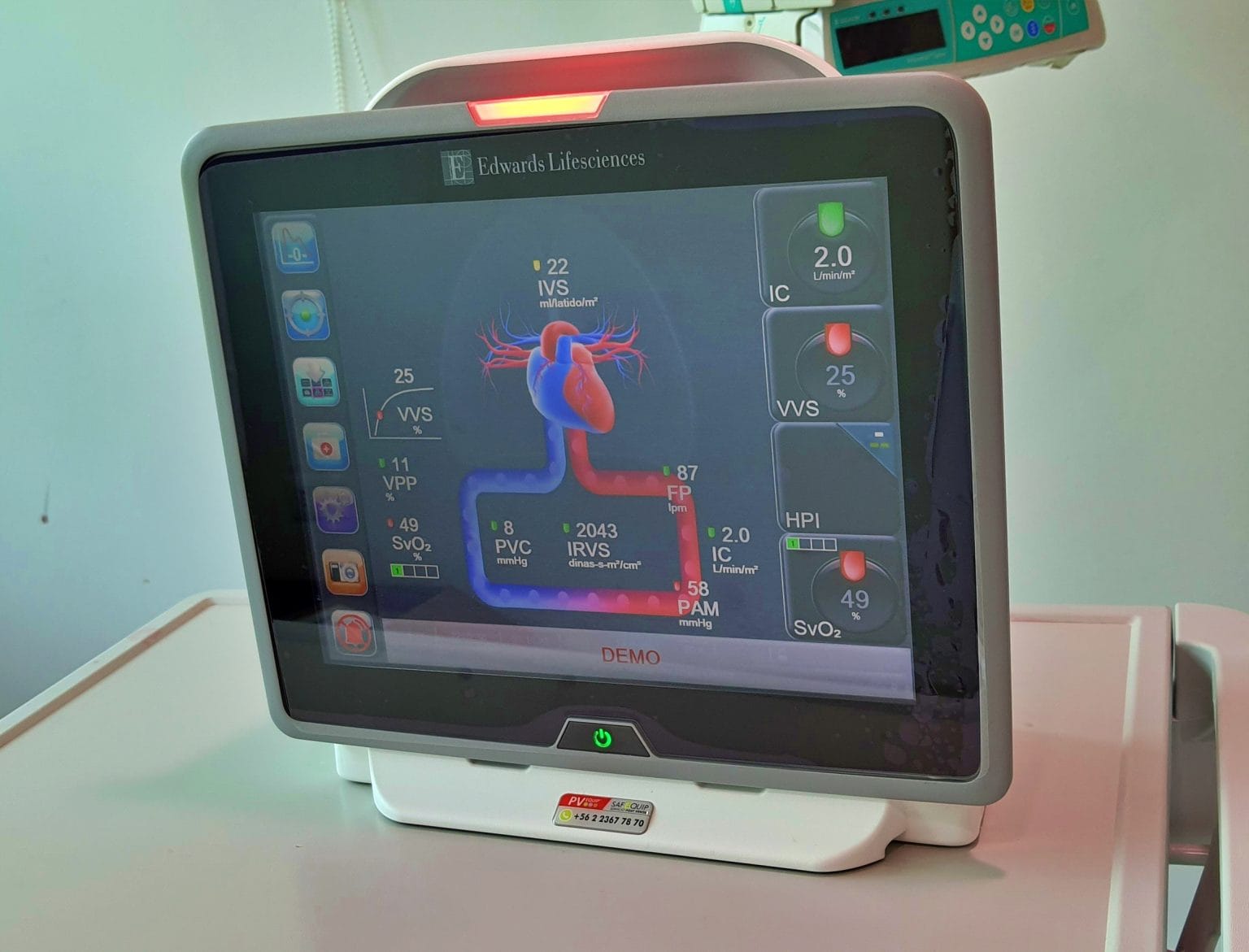 Clínica Sanatorio Alemán ya cuenta con avanzado monitor hemodinámico
