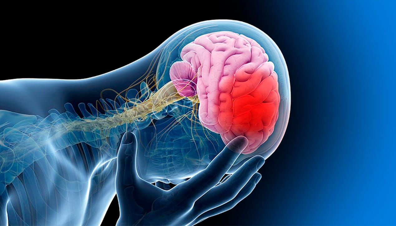 Día mundial del accidente cerebrovascular
