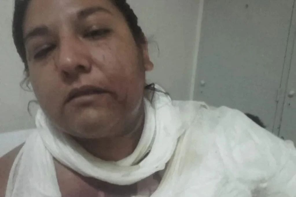 Mujer le lanzó tetera con agua hirviendo a su nuera tras discusión por labores domésticas