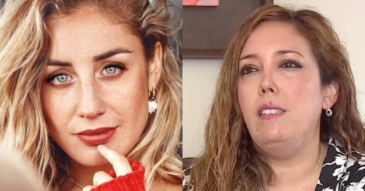 Mujer denunció a Daniela Castro tras ser sufrir ataque por uno de sus perros: La influencer respondió